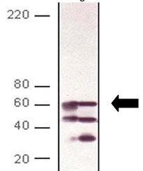 Anti-Calcineurin A (Catalytic) Antibody (56336) - Leinco Technologies