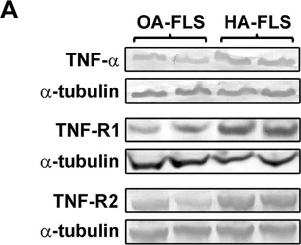 Anti-TNF-R1 Antibody (11062) - Leinco Technologies