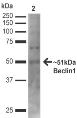 Anti-Beclin 1 Antibody (23010) - Leinco Technologies