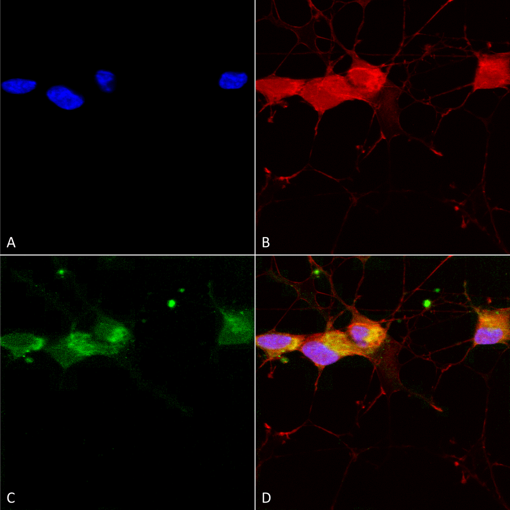 Anti Nr B Glutamate Receptor Antibody Leinco Technologies