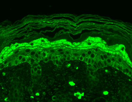 Anti Nr B Glutamate Receptor Antibody Leinco Technologies